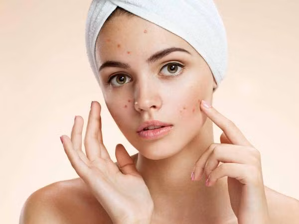 Lớp học giới tính: Có thể dùng dung dịch vệ sinh phụ nữ để… trị mụn được không?
