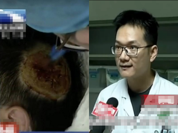 Đặt sạc pin dự phòng dưới gối, một người đàn ông suýt mất mạng