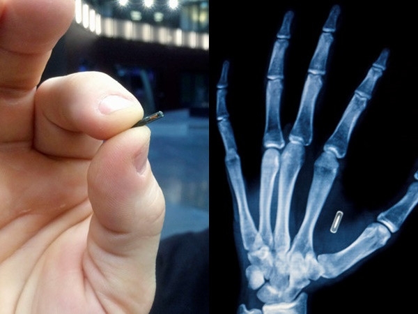 Cấy chip vào người sống - trào lưu đang nổi lên toàn cầu