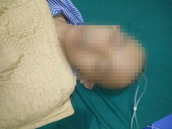 Học sinh bị đánh chấn thương sọ não trong lớp học: Sở GD&ĐT Hà Giang nói gì?