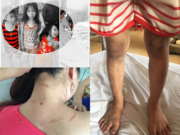 Quảng Bình: 3 đứa trẻ bị cha ruột nhốt trong nhà rồi phóng hỏa