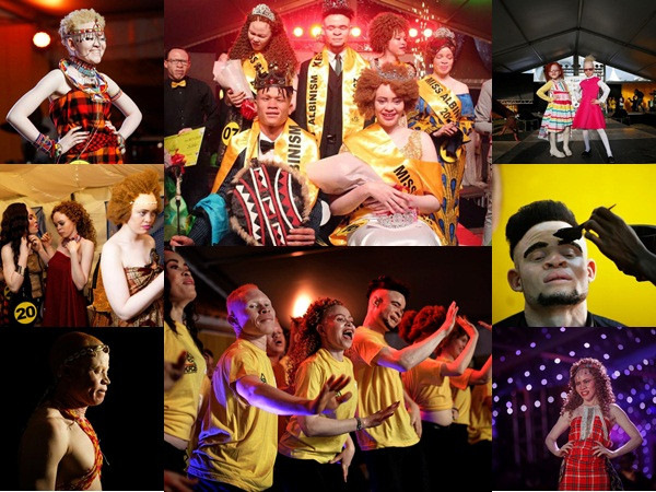 Cuộc thi sắc đẹp bạch tạng và cuộc chiến chống kỳ thị ở châu Phi