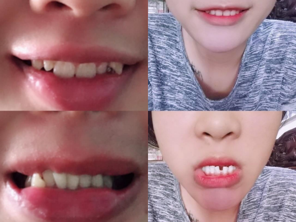 "Cười bò" với loạt ảnh minh chứng: Đúng là ông trời không cho ai tất cả!