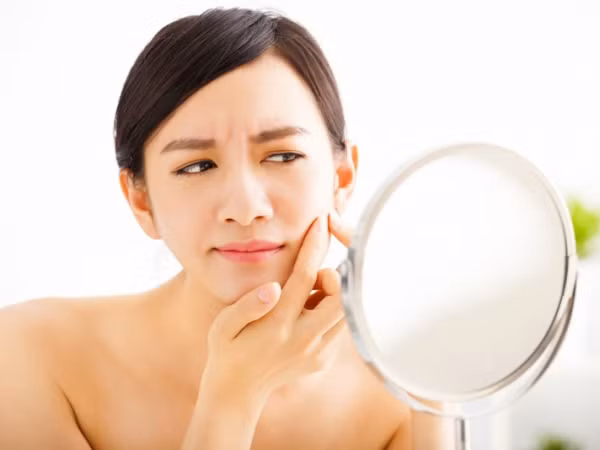Giúp bạn tống khứ hoàn toàn và vĩnh viễn lũ “đèn pin” phiền nhiễu trên da