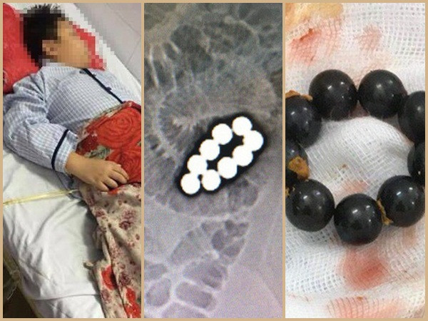 Sẽ làm rõ vụ việc nam sinh lớp 5 bị bạn học ép nuốt 9 viên bi sắt