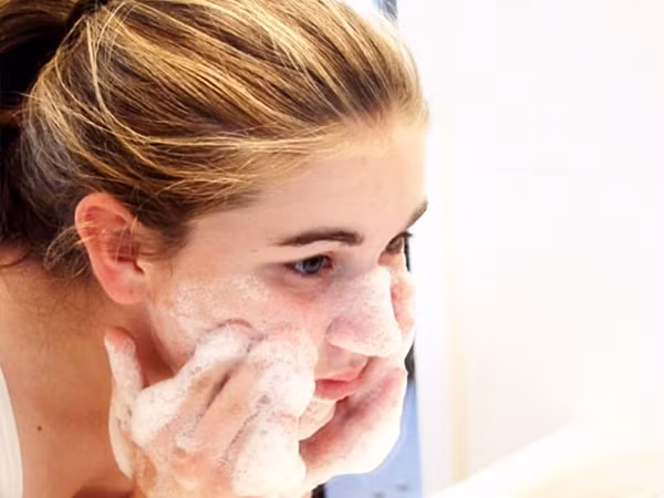 Việc bạn thường xuyên làm khiến mụn “đeo bám” suốt mùa hè