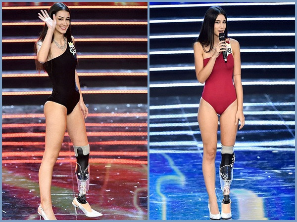 Nghị lực đáng khâm phục của Á hậu Ý bị khuyết tật