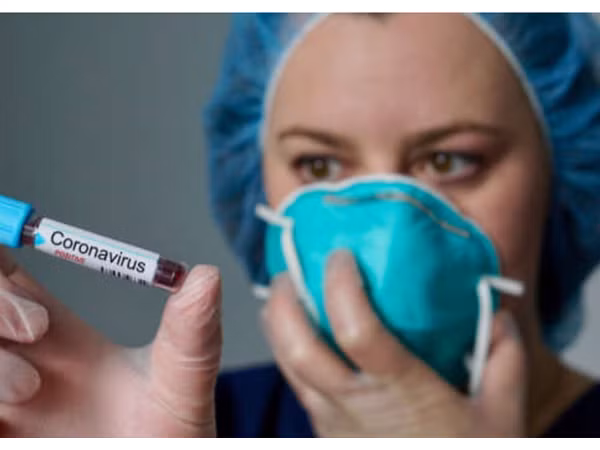 10 điều bạn cần làm ngay để phòng tránh bệnh viêm phổi cấp do virus Corona