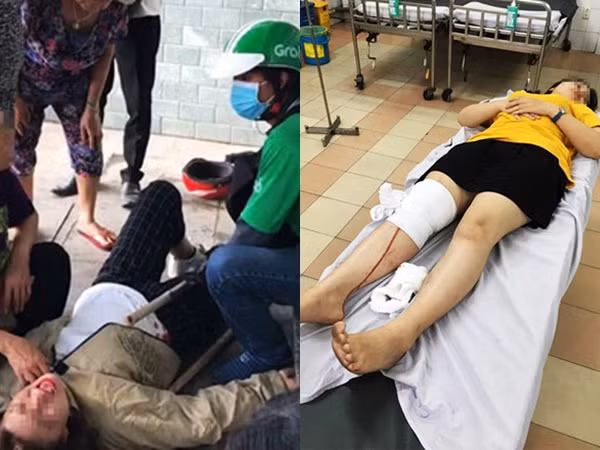 Nóng mạng xã hội: Phẫn nộ trò đùa quái ác khiến 2 nữ sinh té xe, may chục mũi