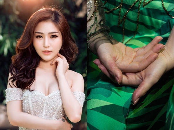 Fan lo lắng cho Hương Tràm khi cô bị mất ngủ, stress đến mức bóc tay rỉ máu