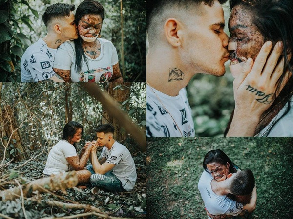 Tình yêu như mơ: Chàng trai dịu dàng ôm cô gái có hình hài xấu xí