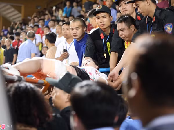 Nữ cổ động viên kể khoảnh khắc bị thương do pháo sáng ở Hàng Đẫy