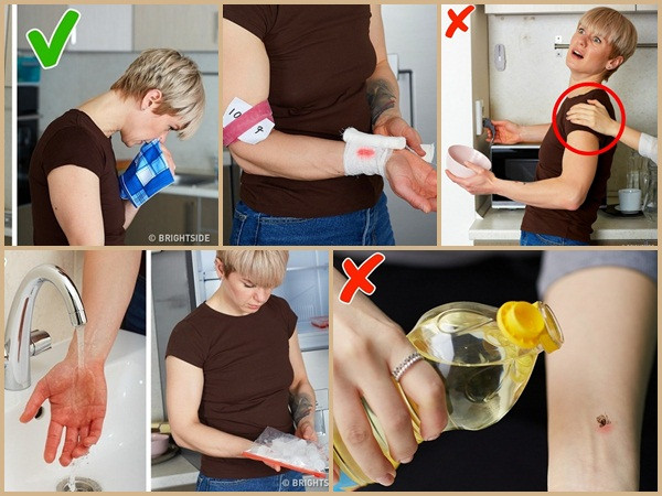 Mẹo tự cứu sống bản thân trong những tai nạn thường gặp