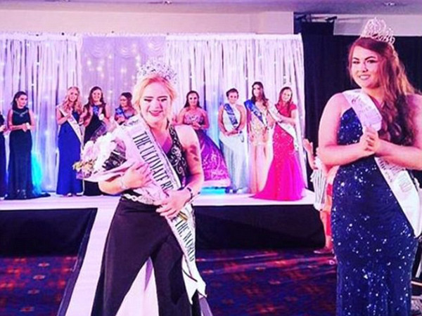 Cô gái mắc hội chứng Down đầu tiên giành giải nhan sắc quốc tế