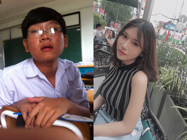 Nam sinh Nghệ An chi nửa tỷ đồng để lột xác ngoạn mục thành cô gái xinh đẹp