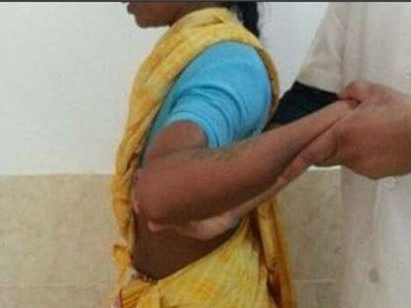 Kỳ lạ cô gái có khả năng xoay vai 180 độ vì lý do không tưởng