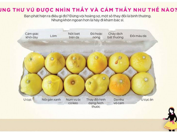 Ung thư vú là căn bệnh nguy hiểm nhất với nữ giới trong danh sách ung thư tại Việt Nam