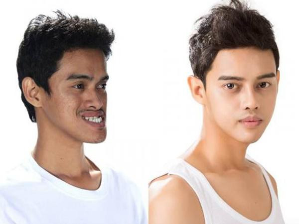 Phẫu thuật thẩm mỹ đã thay đổi số phận một người như thế nào?