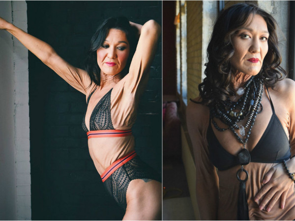 Bạn đã đủ dũng cảm để “ngó lơ” cái đẹp chuẩn mực như cô nàng người mẫu 26 tuổi này?