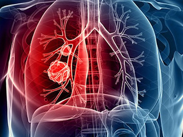 Không chỉ phổi mà các bộ phận tưởng không liên quan này cũng bị tàn phá nếu hút thuốc