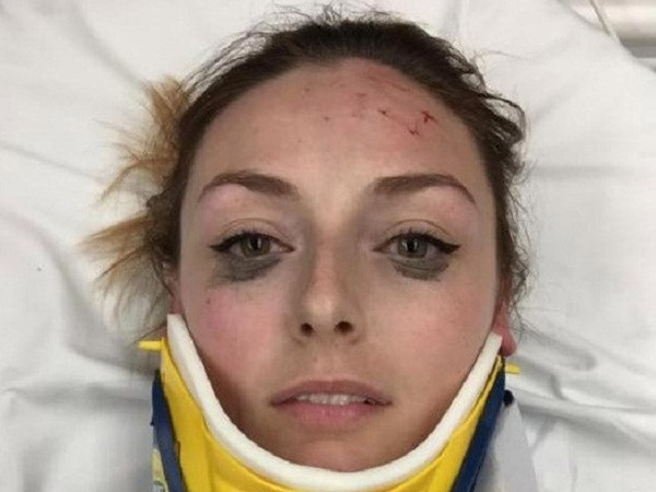 "Bái phục" trước độ "tỉnh" của cô gái, gặp tai nạn xe vẫn không quên review bút kẻ mắt