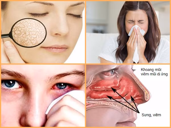 Thời điểm giao mùa và những "vị khách khó ưa" bất ngờ ghé thăm, phải làm sao?