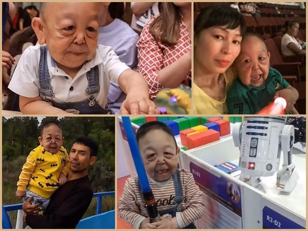 Cậu bé 6 tuổi có bộ mặt "ông lão"