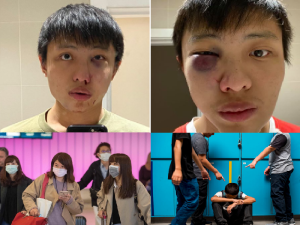 Trong "tâm bão" virus corona, nạn phân biệt chủng tộc bùng nổ nhắm vào người châu Á