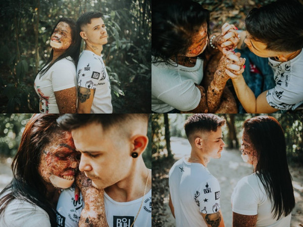 Chuyện tình cổ tích của cặp đôi Brazil khiến ai cũng tin rằng "tình yêu là không ranh giới"