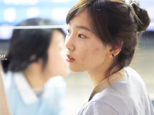 Giật mình khi nhìn thấy làn da thật sự của idol K-Pop khi đã tẩy trang