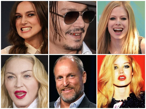 Dàn sao đình đám Hollywood biến hàm răng xấu thành lợi thế riêng
