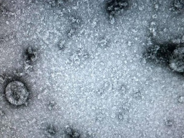 Việt Nam nuôi cấy và phân lập thành công nCoV