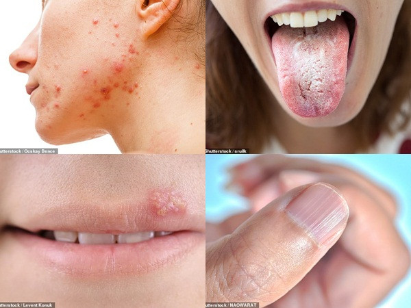 Những dấu hiệu “lạ” mà cơ thể đang cố nói với bạn