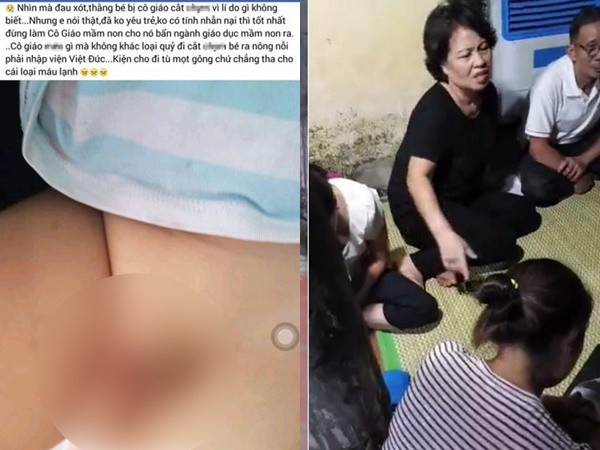 Điều tra vụ cô giáo mầm non bị tố khiến "vùng kín" của bé trai 2 tuổi phải khâu nhiều mũi