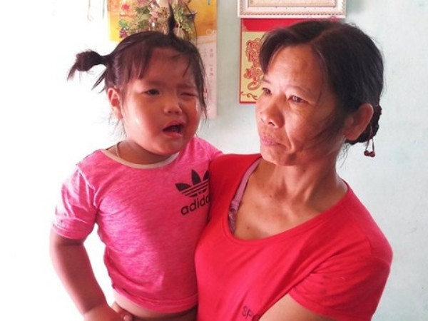 Thanh Hóa: Nghi án cô giáo mầm non đánh bé 3 tuổi méo miệng, liệt dây thần kinh