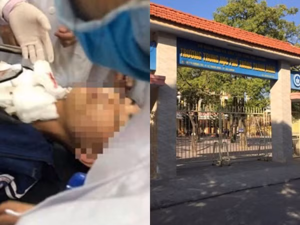 Hải Dương: Học sinh trường THPT Thành Đông bị đâm trọng thương khi tan trường