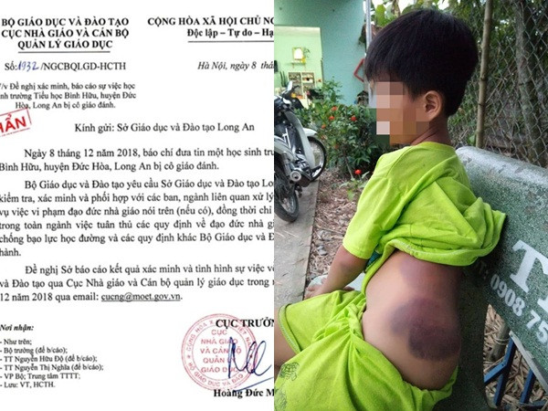 Bộ GD&ĐT yêu cầu báo cáo khẩn vụ học sinh lớp 1 nghi bị cô giáo đánh