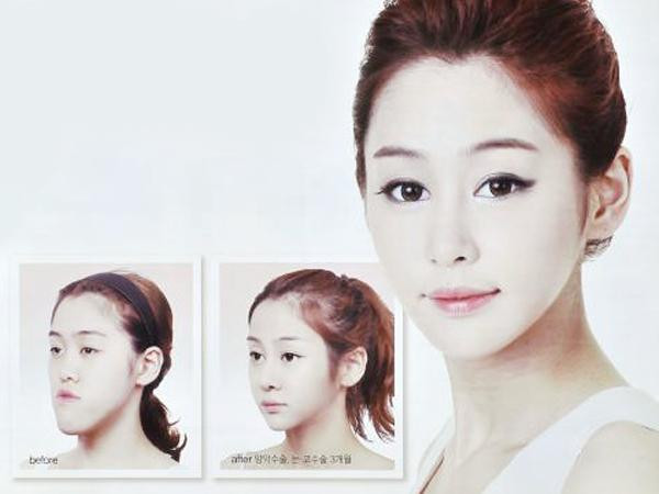 Giới trẻ Hàn phẫu thuật thẩm mỹ từ khi... học Tiểu học?