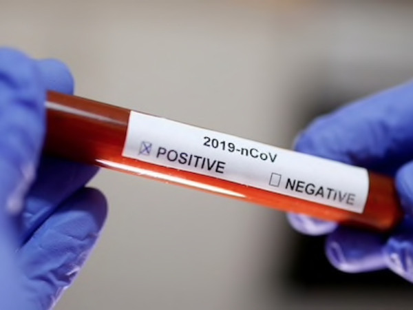 Việt Nam thêm 5 ca nhiễm COVID-19: Bé 2 tuổi cùng 4 người lây từ bệnh nhân số 34