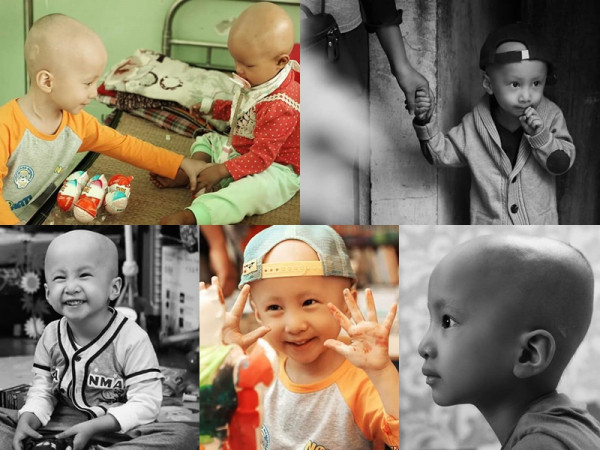 24h của Tom: Bộ ảnh xúc động về em bé bị ung thư não khi mới 33 tháng tuổi 