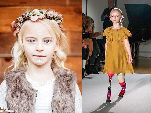 Anh: Người mẫu nhí đặc biệt tự tin sải bước trên sàn catwalk