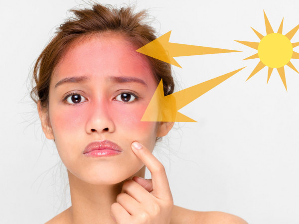 Đừng để làn da bạn phải lên tiếng kêu cứu vì bị ánh nắng tấn công