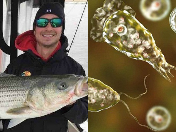 Chàng trai tử vong vì amip ăn não người