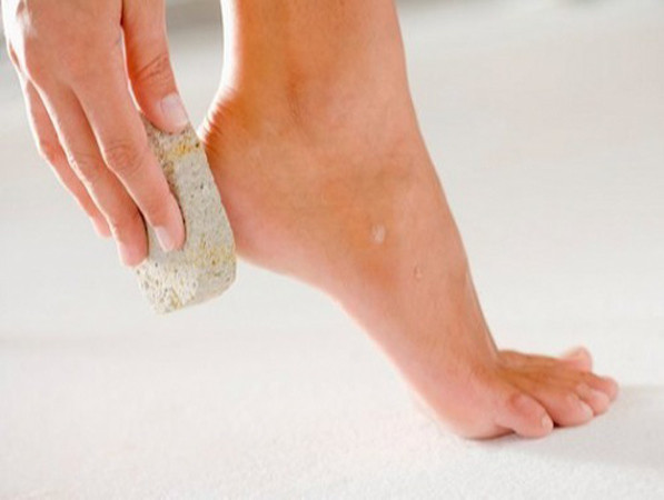 Chữa nứt gót chân cực dễ cho các cô nàng mùa lạnh