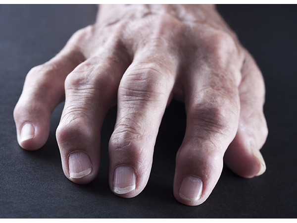 Những tác hại khủng khiếp nhưng “không nhìn thấy ngay” của thuốc lá đối với sức khỏe 