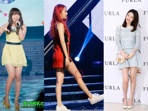 Đây là lý do khiến nhiều idol K-Pop bỗng dưng xuất hiện nốt ruồi bí ẩn ở trên chân