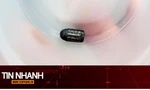 TIN NHANH: Hy hữu người phụ nữ sống sót dù bị đạn lạc găm trúng đầu