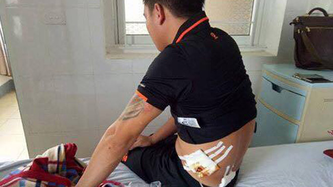 Dùng súng truy sát tại quán karaoke, 3 thanh niên nhập viện cấp cứu