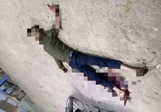 Hình ảnh nam thanh niên tự cắt tay chân nằm bất động trước cây xăng rạng sáng nay 28-10