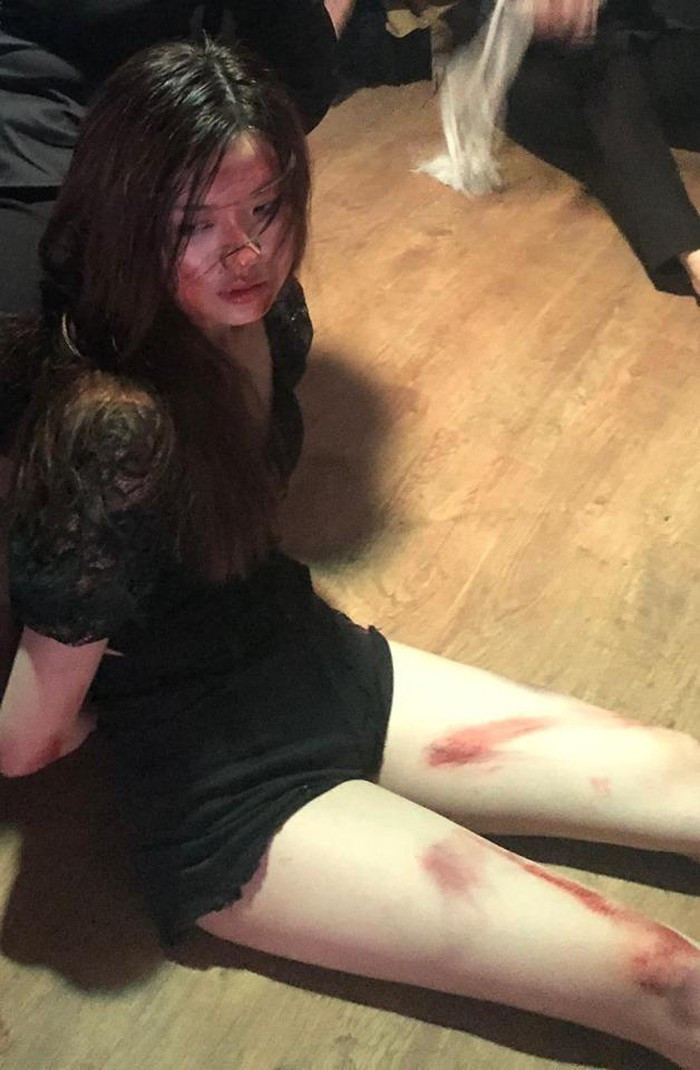 Trà tiểu tam bầm dập trong 'Hoa hồng trên ngực trái'